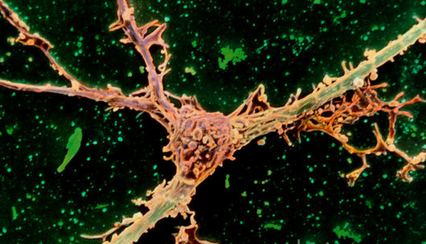 Ветвистый олигодендроцит (красный), сидящий на нейронном аксоне (зелёный) (фото <noindex><a target=_blank href=http://www.sciencephoto.com/>Dr. John Zajicek</a></noindex>).