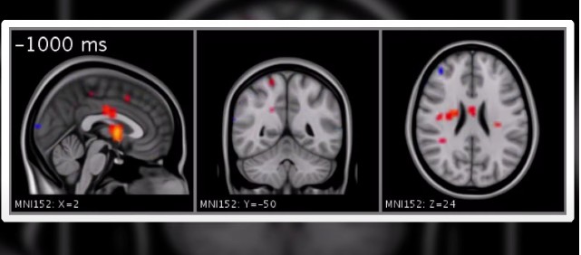 Люди считают себя особенными и неповторимыми. Мы измеряем коэффициент своего интеллекта, гордимся количеством извилин и уникальных областей мозга.-5