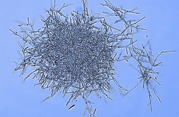 Грибы из кишечника (фото авторов исследования).